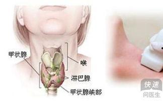 甲亢吃角瓜好吗,角瓜的营养与益处解析